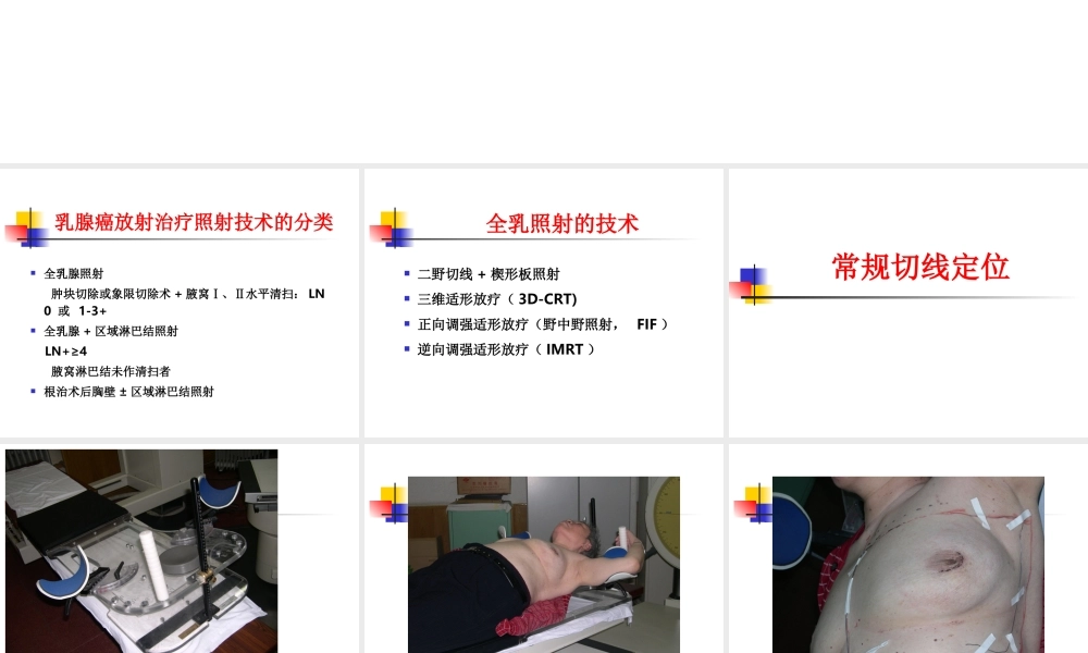乳腺癌照射技术-余子豪.ppt