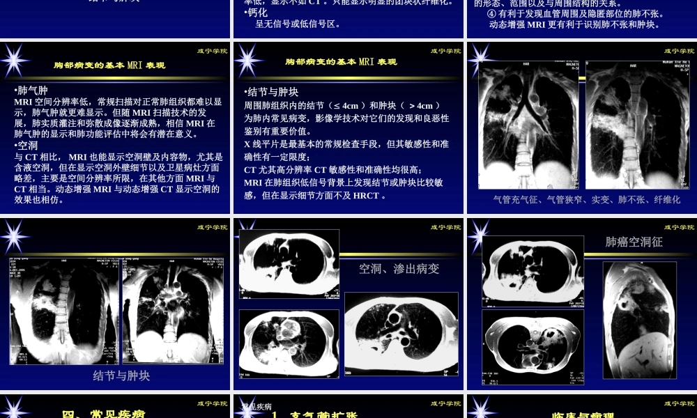 呼吸系统MRI(影像).ppt