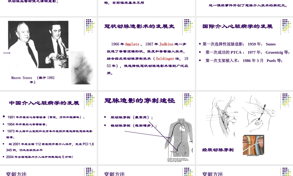 冠脉造影术jiangkegao.ppt