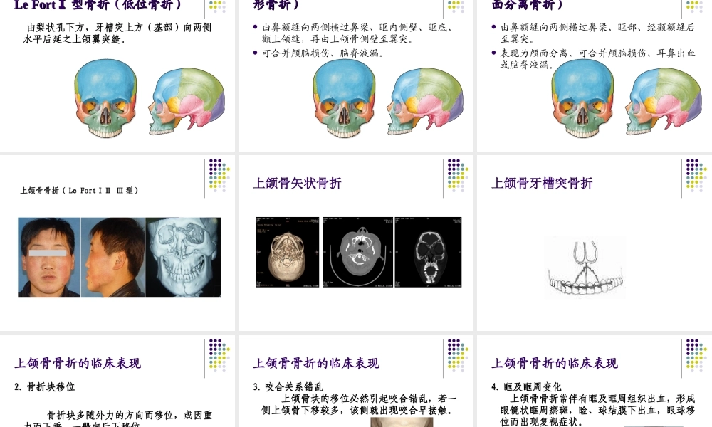 口腔颌面外科-颌骨骨折.ppt