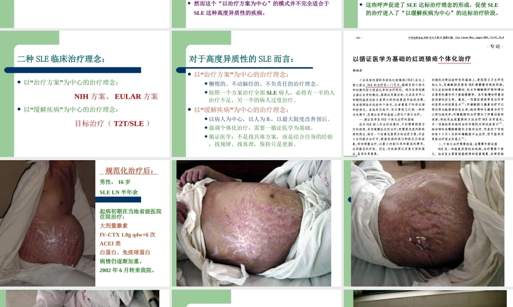杨岫岩.系统性红斑狼疮(2015年省医).ppt