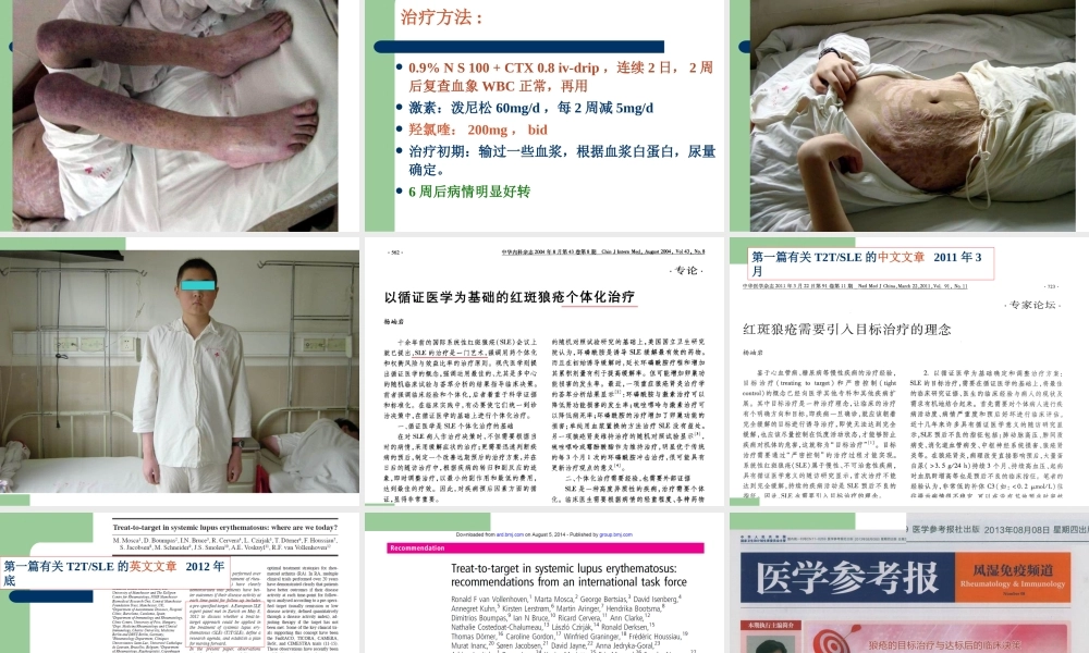 杨岫岩.系统性红斑狼疮(2015年省医).ppt