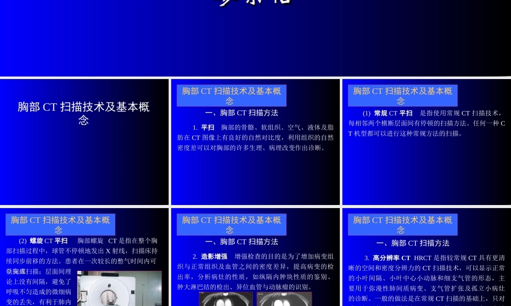 呼吸CT新.ppt