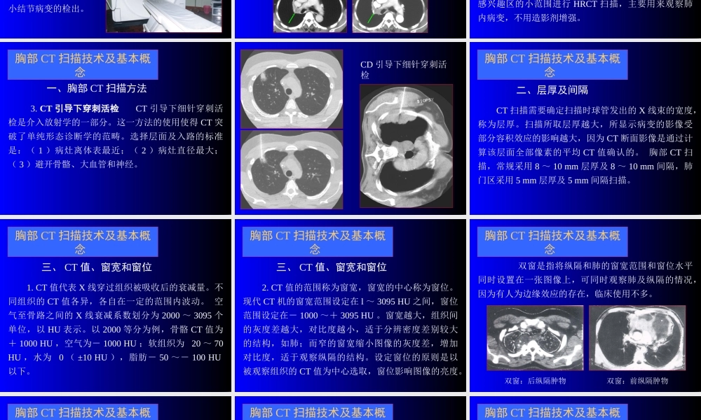 呼吸CT新.ppt