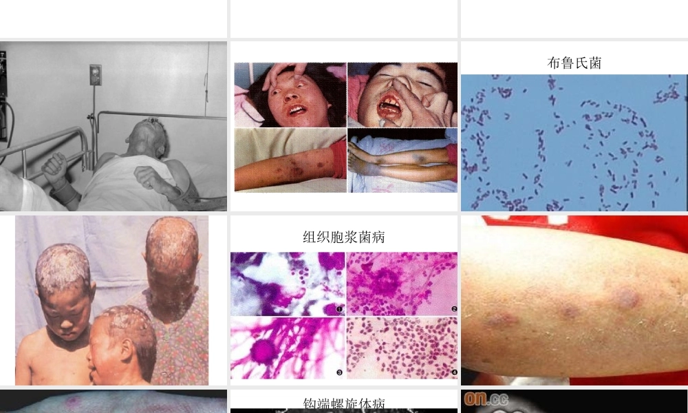 犬人共患传染病.ppt