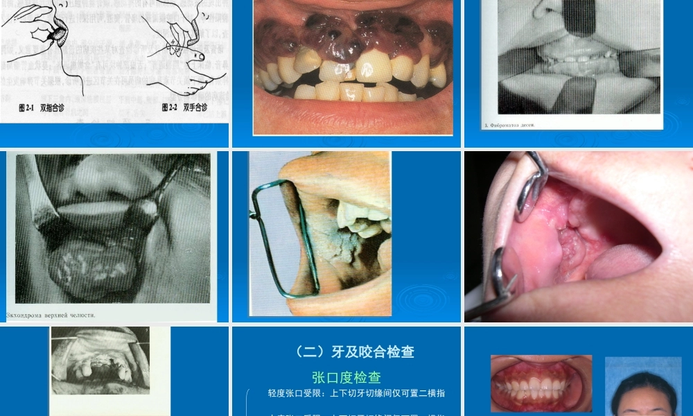 口腔颌面外科专科检查.ppt