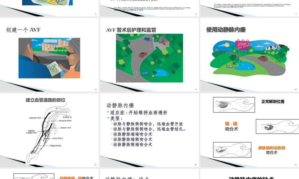 血液净化血管通路.pptx