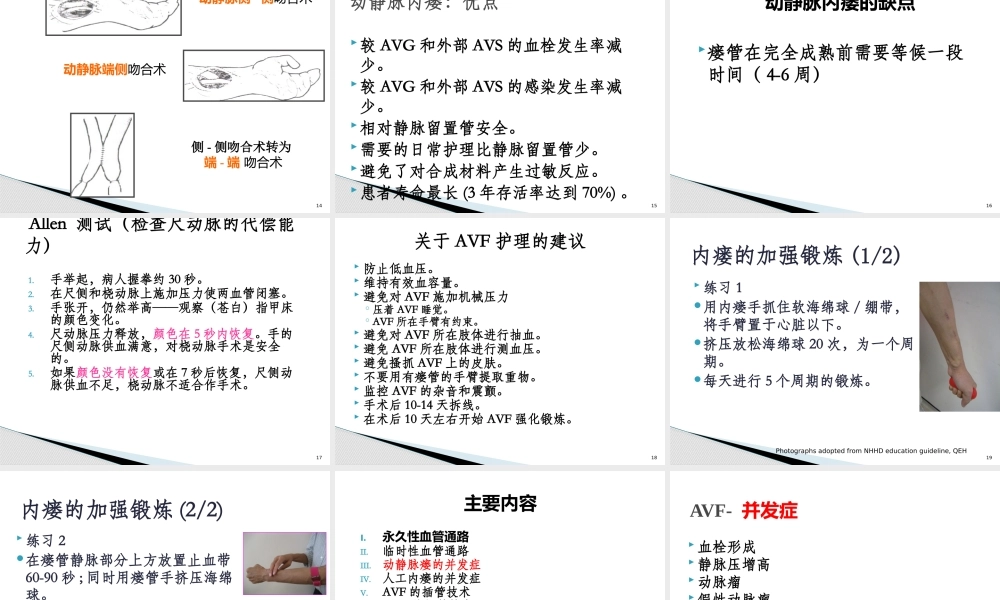 血液净化血管通路.pptx