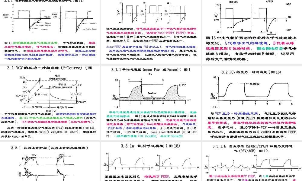 呼吸机波形分析.ppt