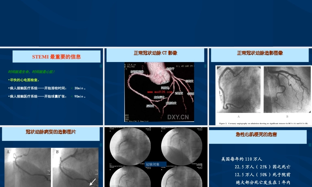 急性心肌梗死的紧急救治.ppt