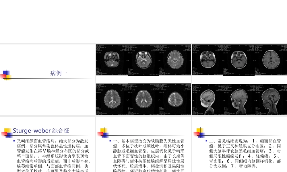 MRI颅脑典型病例.ppt