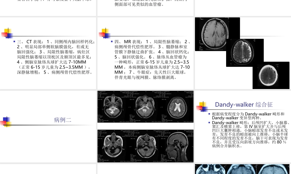 MRI颅脑典型病例.ppt
