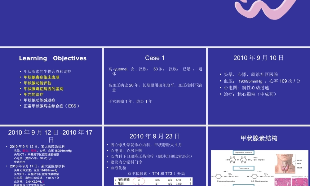 甲状腺病.ppt
