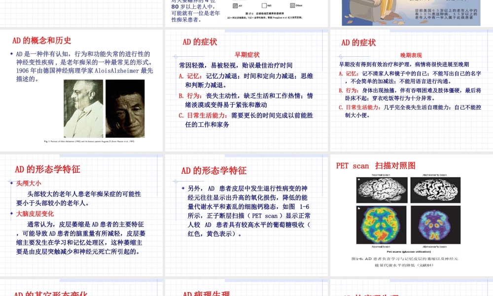 抗老年痴呆药精讲.ppt