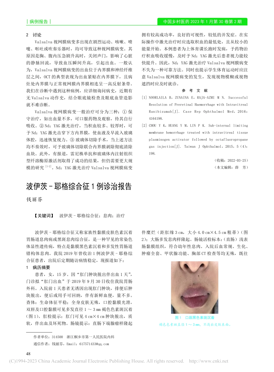 Valsalva视网膜病变1例_徐涛.pdf_第2页