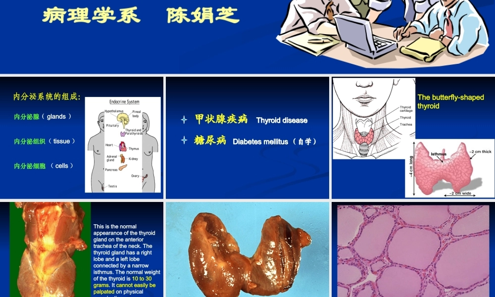 甲状腺-糖尿病-cjz.ppt