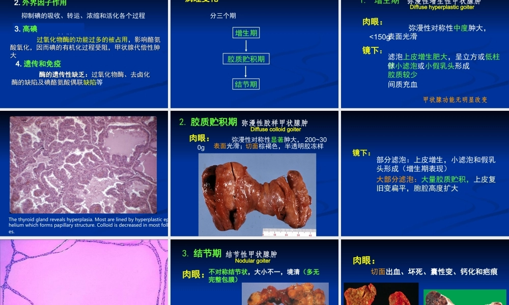 甲状腺-糖尿病-cjz.ppt