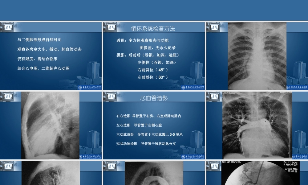 CT和MR在心脏大血管中的应用.ppt