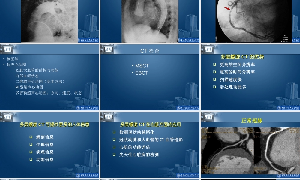 CT和MR在心脏大血管中的应用.ppt