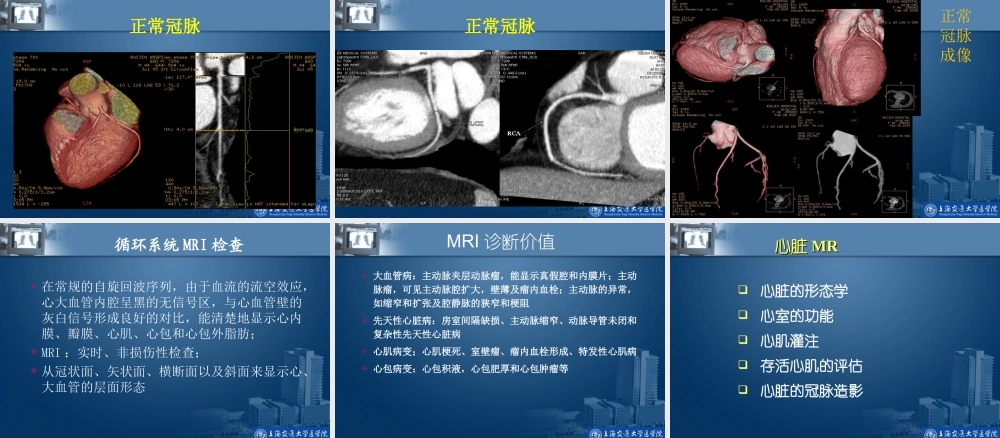 CT和MR在心脏大血管中的应用.ppt