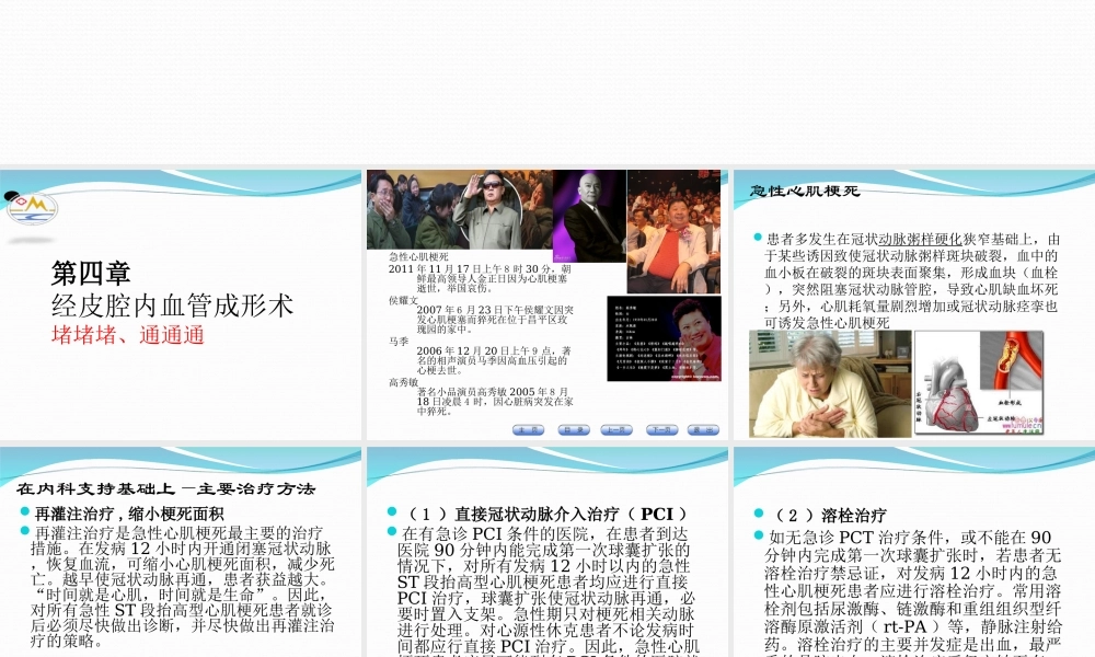 介入放射学第四章--经皮腔内血管成形术.ppt