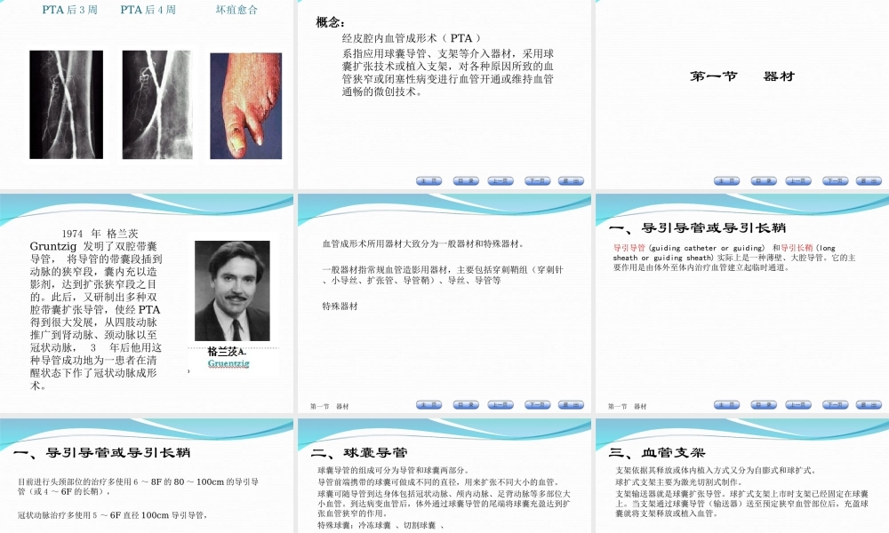 介入放射学第四章--经皮腔内血管成形术.ppt