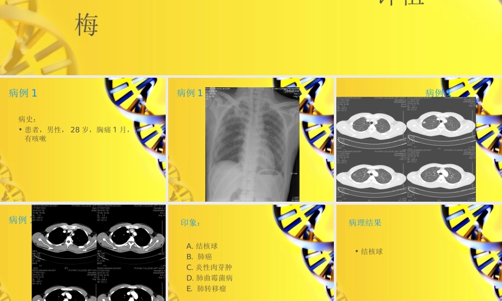 《病例讨论分析》ppt件.ppt