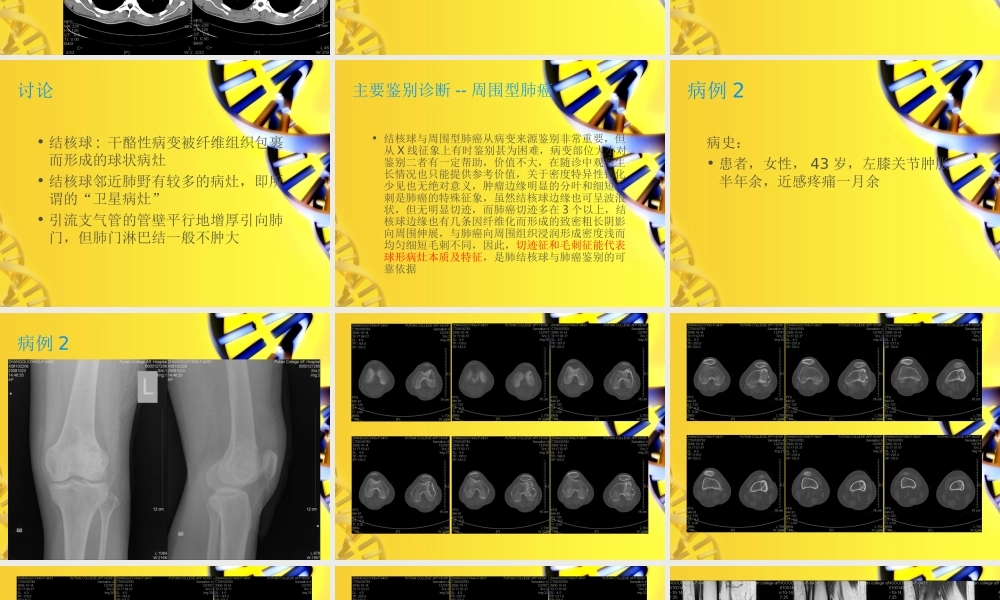 《病例讨论分析》ppt件.ppt
