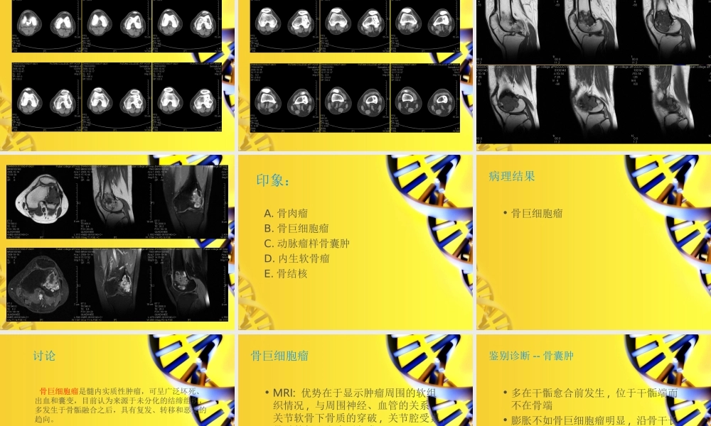 《病例讨论分析》ppt件.ppt