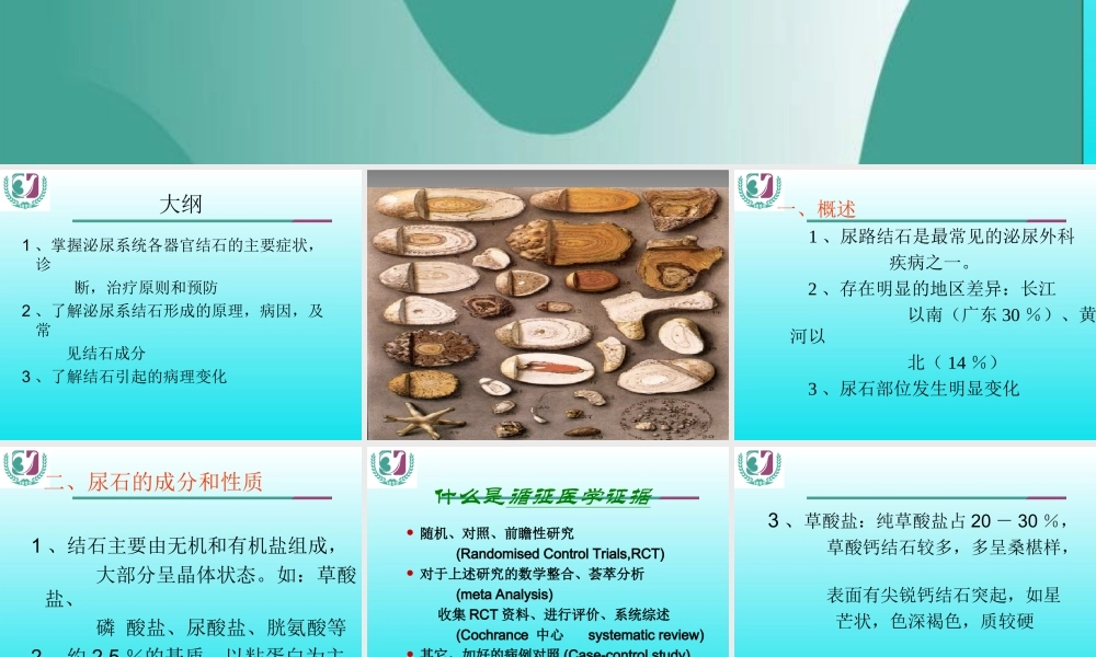 尿石症(2013).ppt