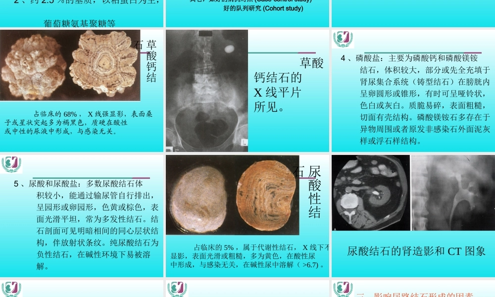 尿石症(2013).ppt