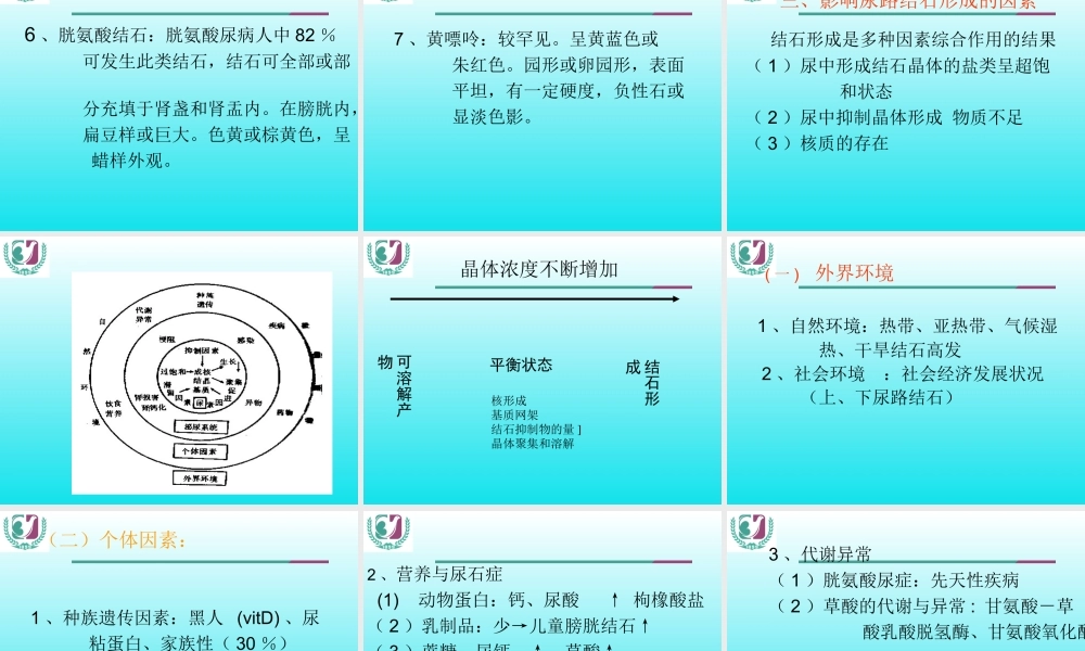 尿石症(2013).ppt