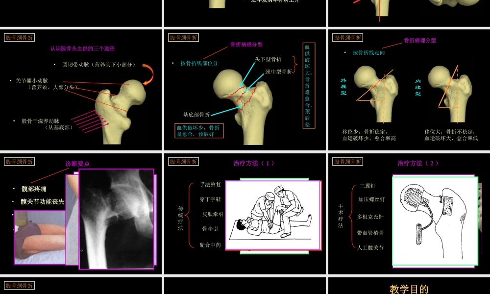民勤县医院下肢骨折系列.ppt