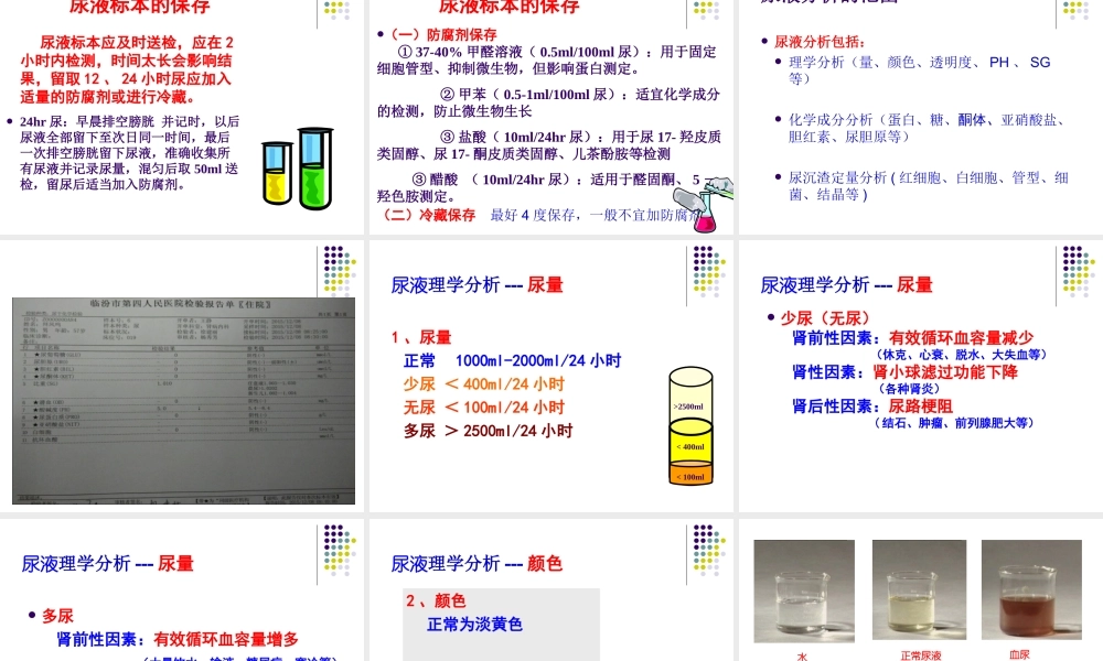 尿液检查分析.ppt