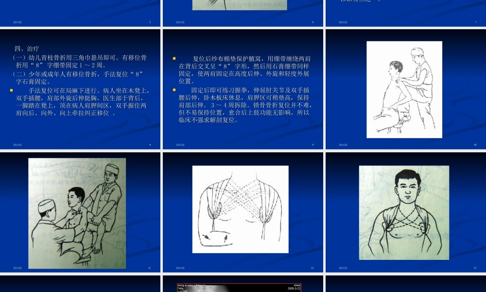 507上肢骨、关节损伤1.ppt