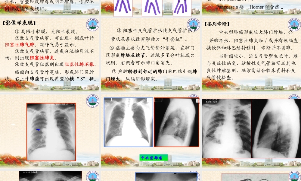 呼吸系统2(影像-).ppt