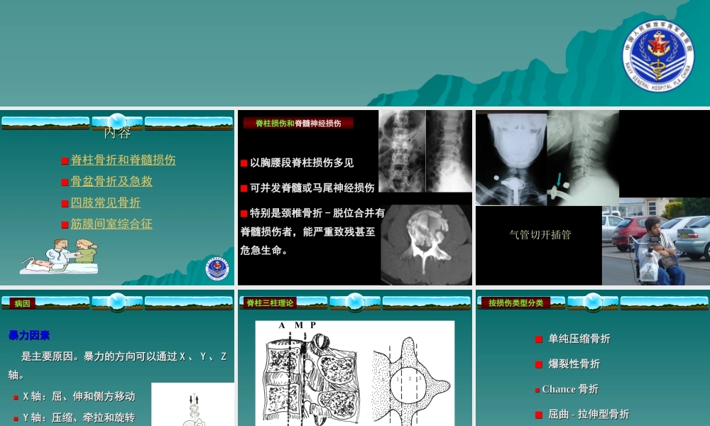 四肢脊柱骨折的紧急处理.ppt