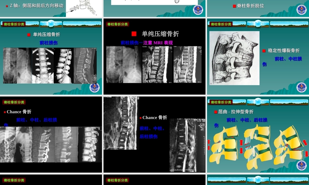 四肢脊柱骨折的紧急处理.ppt