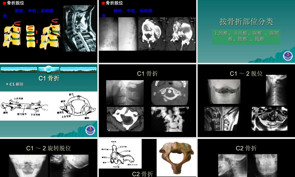 四肢脊柱骨折的紧急处理.ppt