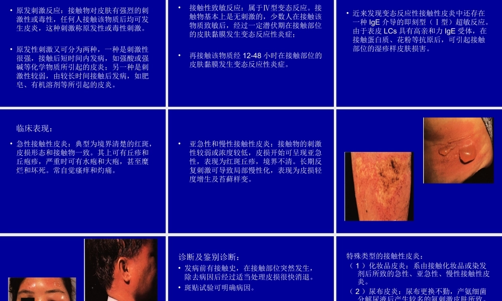 常见皮炎介绍模板.ppt