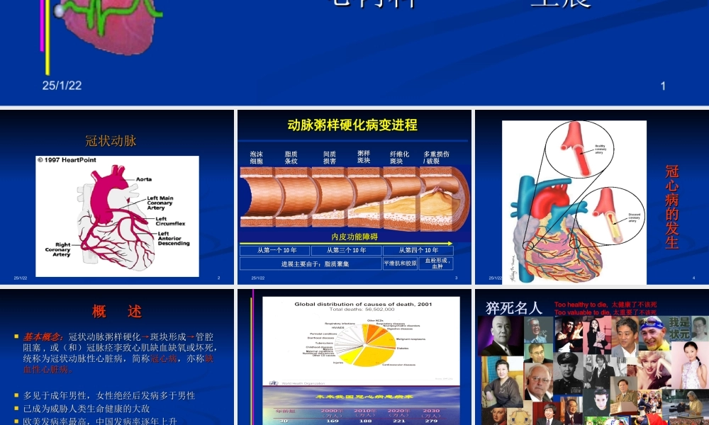 冠状动脉粥样硬化性心脏病2013第八版.ppt