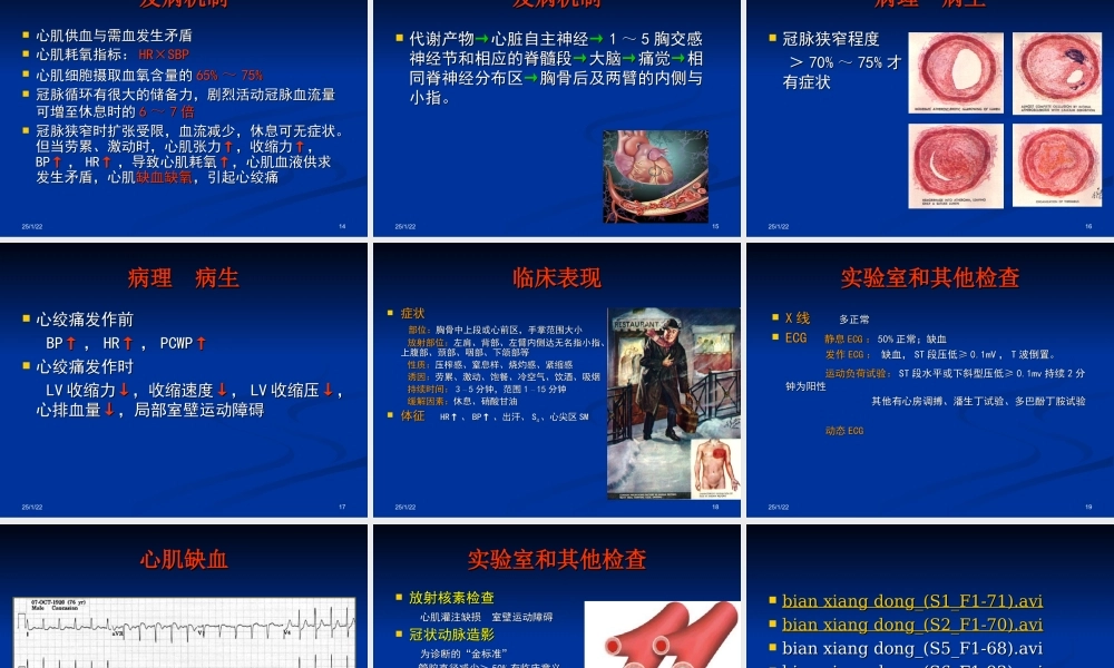 冠状动脉粥样硬化性心脏病2013第八版.ppt