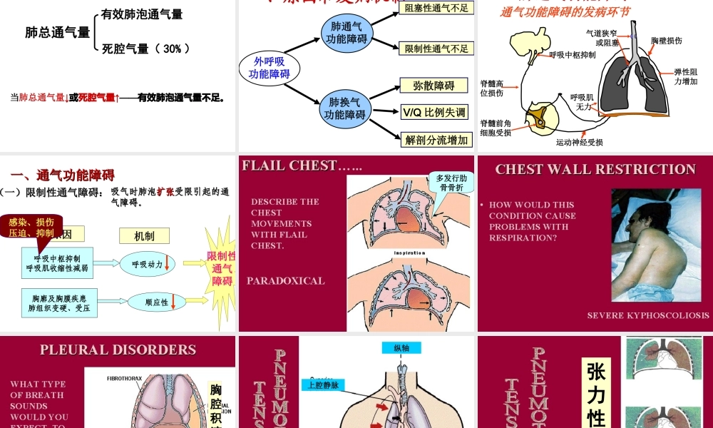 呼吸衰竭(七版).ppt