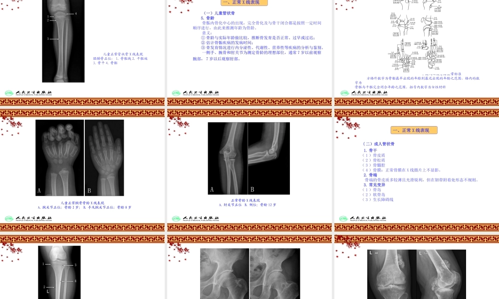 《骨伤科影像学》第一章总论.ppt