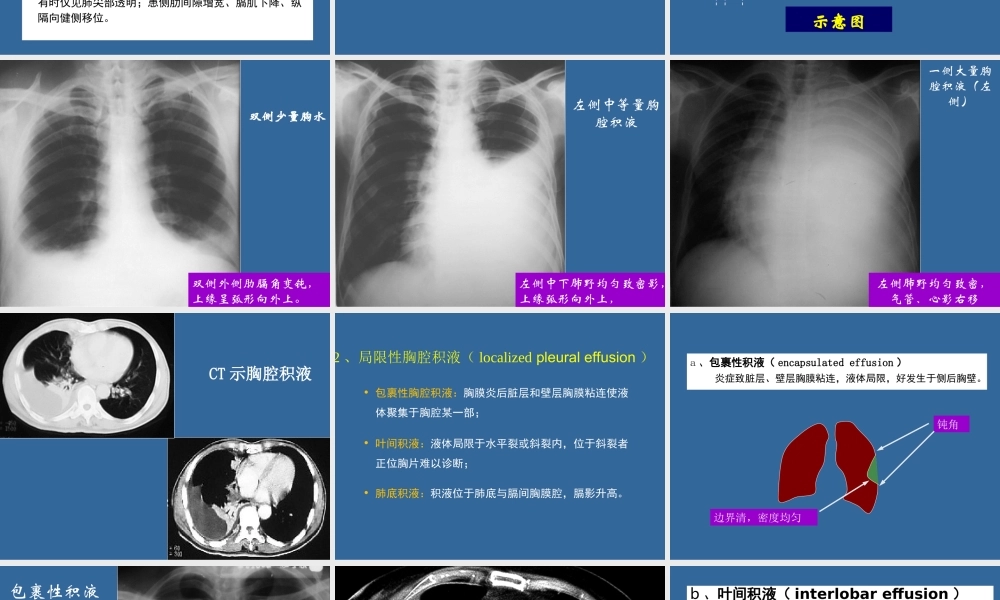 呼吸系统二-3.13.ppt
