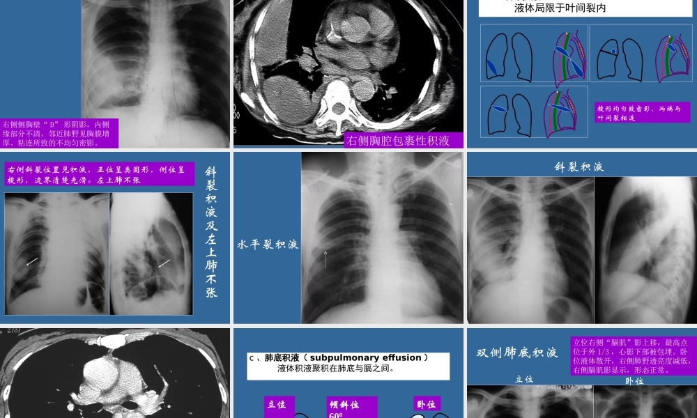 呼吸系统二-3.13.ppt
