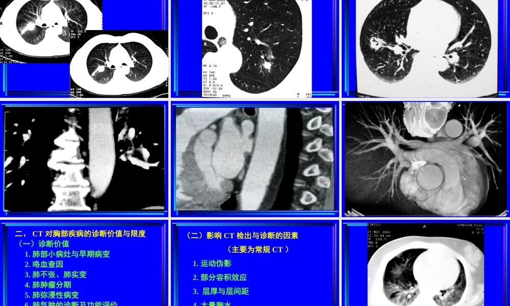 住院医师胸部CT诊(超量实例CT片).ppt