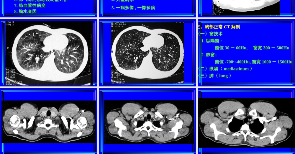 住院医师胸部CT诊(超量实例CT片).ppt