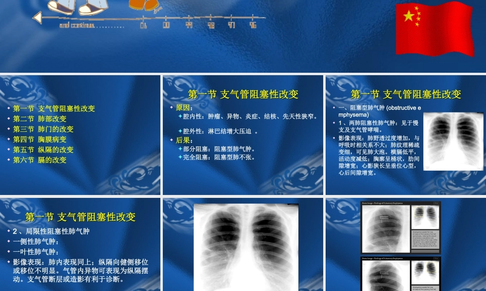 呼吸系统基本病变的影像学改变.ppt