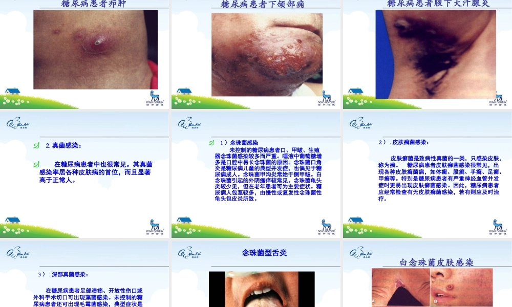 8.24糖尿病患者的皮肤表现.ppt